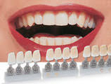 Find Out The Shade Needed For Your New Crowns Bridges