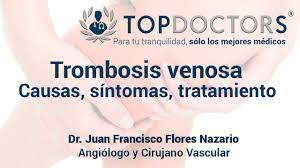 Oct 09, 2020 · la trombosis venosa profunda ocurre, generalmente en las venas de las piernas, mientras que el embolismo pulmonar sucede cuando el coágulo bloquea las venas de alguno de los pulmones. Sintomas Causas Y Tratamiento De La Trombosis Youtube