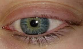 Die behandlung mit wimpernzangen, wimperntusche und das tägliche abschminken strapaziert die wimpern. Wachsen Alle Wimpern Vollstandig Nach Gesundheit Beauty Schmerzen