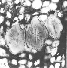 Image result for Allocassine laurifolia