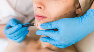 If you have a lung injury or illness, your doctor may tell you you need to have lung surgery as part of your treatment. How Plastic Surgery Trends Are Influenced By Region Allure