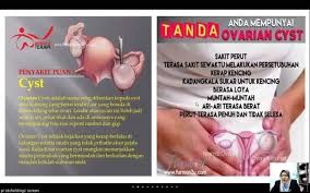 Saya pernah kena major operation bila cyst tu pecah & masuk setelah ada yang memberitahu ada masalah cyst atau fibroid, mula seorang demi seorang mengaku memilikinya juga. Tanda Anda Mempunyai Ovarian Cyst Safe Joy Hakak Comel Facebook