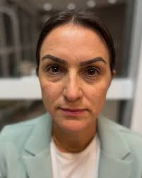 Histórias reais, resultados naturais e mulheres que decidiram se  escolher!✨🤍