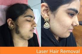 Your search for top skin doctor in bandra ends with an appointment with dr rinky kapoor, director the esthetic clinics. Best Skin Clinics In Ahmedabad Book Appointment View Reviews Address Timings Practo Page 2
