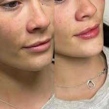 Katie Ley (@oh_molly_aesthetics) • Instagram photos and videos