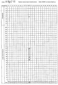 79 Methodical Pulse And Respiration Chart