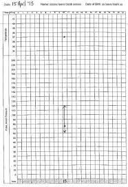 79 Methodical Pulse And Respiration Chart