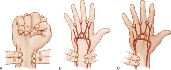 Image result for Hand Exam