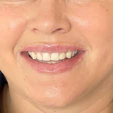 Happy Birthday to my boss! Have a good one Dr. Aker!!! #bestdoctors  #plasticsurgeon #birthday #miricleworker @akeraesthetics