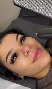 Hey all, My friend is looking for someone who is needing models for lip  injections. Western suburbs! Thank you 🙂