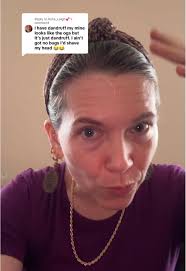 Replying to @Kota_Leigh💕 #greenscreen #lice #invertedfilter  #erasethestigma If you’re seeing black dots with the filter, trust me,  you’re just looking at dandruff. Promise it’s no biggie.