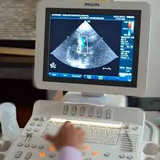 Doppler colorido de arterias viscerais (mesentericas superior e inferior e tronco celiaco). Ecodopplercardiograma Com Estresse Farmacologico Cardiocare