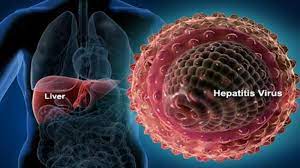 Menyebar dari makanan atau air yang terkontaminasi, atau kontak dengan seseorang yang terinfeksi. Apa Itu Penyakit Hepatitis A Berikut Gejala Penyebab Dan Faktor Risikonya Tribunnews Com Mobile