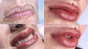 See more ideas about lip liner tattoo, permanent makeup, lip permanent makeup. Lip Blushing Tattoo Treatment Darkens Lip Color Before And After Photos Allure