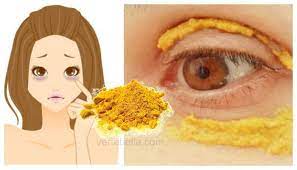 Curcuma Para Las Ojeras Turmeric Tumeric Face Mask Simple Skincare