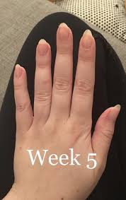 Castor oil is very concentrated in omega 9 which gives it nutritional power. 21 Things To Help You Maintain Healthy Nails