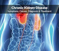 Educational information, prevention, risks, symptoms, and renal (kidney) disease impacts the ability of the kidneys to clear waste and excess fluid from the body.1. Chronic Kidney Disease Chronic Renal Failure Symptoms Causes Diagnosis Treatment
