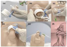 Image result for Retrograde Urethrogram