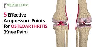 5 Effective Acupressure Points For Osteoarthritis Relief