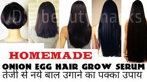 The nutrients also help stimulate new hair growth, adding volume and thickening your hair. Best Onion Egg Hair Regrowth Serum For Double Hair Growth Youtube