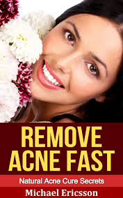 Remove Acne Fast: Natural Acne Cure Secrets eBook by Dr. Michael Ericsson