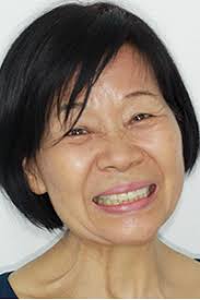 Procedimientos exitosos