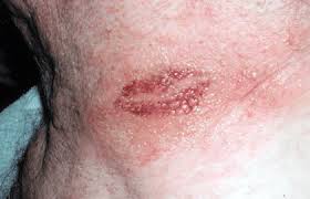 It seems that no matter how sophisticated tattoo technology becomes, there are still many who believe it to be. Tattoos 7 Unexpected Skin Reactions And What To Do About Them