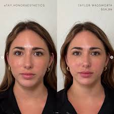 Kyle Appleford's new love showing off her cosmetic procedures :  r/YTVloggerFamilies