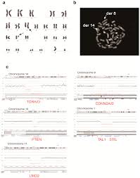 Check spelling or type a new query. Cells Free Full Text A Novel T 8 14 Q24 Q11 Rearranged Human Cell Line As A Model For Mechanistic And Drug Discovery Studies Of Notch1 Independent Human T Cell Leukemia Html