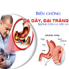 Viêm quanh khớp vai bệnh học: Hot Dáº¡ Day Nháº¥t Dáº¡ Khang Co Tá»'t Khong Gia Bao Nhieu Mua á»Ÿ Ä'au