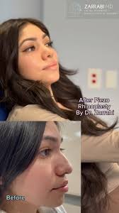 Dr. Shahrouz Zarrabi, MD (@dr.shahrouz.zarrabi) • Instagram photos and  videos
