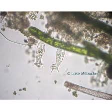 4b) coccidia in kittens and cats (feline coccidiosis). Microscopy Protozoans Microbus Microscope Educational Website