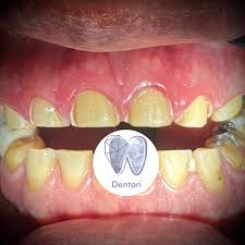 Clínica Dental Dentari - Dentista en Ciudad Azteca, Ecatepec.