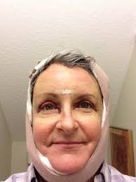 Did Not Have Side or Top Vision, It Was Like Tunnel Vision