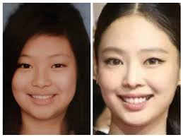 Jennie's plastic surgery : r/BLACKPINKSNARK