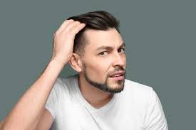 When it comes to men and hair loss, mpb is a term used frequently, and it's also known as androgenic or androgenetic alopecia. How To Tell If You Re Going Bald The Bald Company