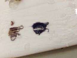 Laporan Akhir Praktikum Laporan Praktikum Analisis Kadar Paracetamol Dengan Metode Nitrimetri Analisis Farmasi