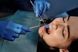 Check spelling or type a new query. What S Involved In Root Canal Therapy Sydney Road Dental Care Manly Northern Beaches