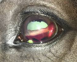 Image result for Hyphema