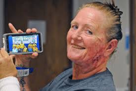 Woman shares scars from near-death experience