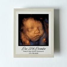 Image result for tbn:T5UajvfpShvp6M::www.photoslinks.com/index.php%3Foption%3Dcom_joomgallery%26func%3Dwatermark%26catid%3D4%26id%3D23%26Itemid%3D2