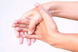 Dupuytren's contracture (also called dupuytren's disease, morbus dupuytren, viking disease, and celtic hand) is a condition in which one or more fingers become permanently bent in a flexed position. Que Es La Contractura De Dupuytren Causas Y Tratamiento