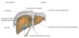 Concept Of The Pathogenesis And Treatment Of Cholelithiasis