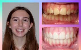 Knoxville Orthodontics