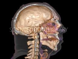 Normal Head 3d Ct Scan Stock Image C007 0533 Ct Scan Scan Stock Images
