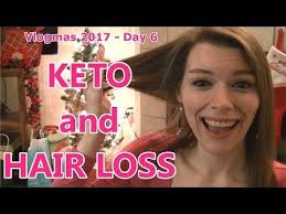 Keto Hair Loss Before And After Pictures Youtube Keto Hair Loss Hair Loss Diet Hair Loss