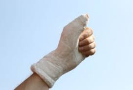 Broken fingers usually are caused by trauma such as playing sports, punching an object, falls, and workplace accidents. 15 000 Compensation Payout For A Broken Thumb Accident At Work Compensation Amounts Calculator