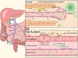Answer to the blood vessel which carries blood from the alimentary canal to the liver is the question: The Gut Liver Axis In Immune Remodeling New Insight Into Liver Diseases