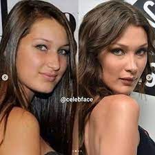 Rom gliedert sich in vier stadtbezirke, 15 munizipien und 155 stadtbereiche. Yolanda Verteidigt Tochter Bella Hadid Wegen Op Geruchten Blick