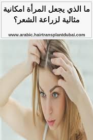 ما الذي يجعل المرأة امكانية مثالية لزراعة الشعر زراعة شعر في دبي hair loss treatment hair hair loss